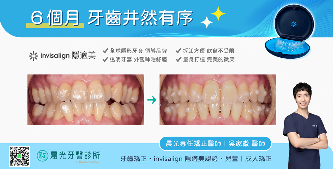 6個月牙齒井然有序