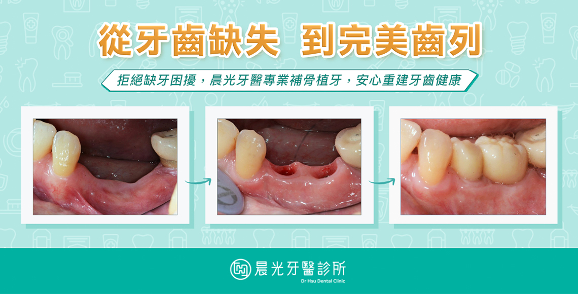 重建完美齒列的關鍵