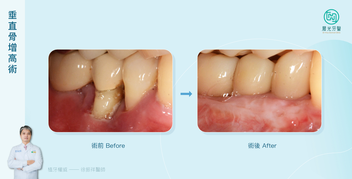 終於能好好的吃東西了