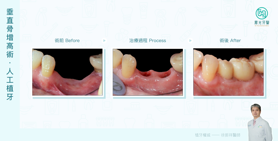 重建完美齒列的關鍵